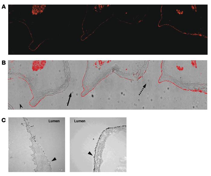 Regional expression of CD39 in the murine aorta.
Coronal sections of a W...