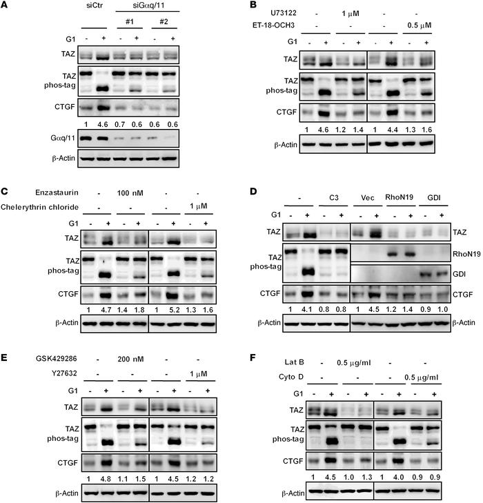 GPER acts through Gαq/11, PLCβ-PKC, and Rho/ROCK to stimulate TAZ.
(A) G...
