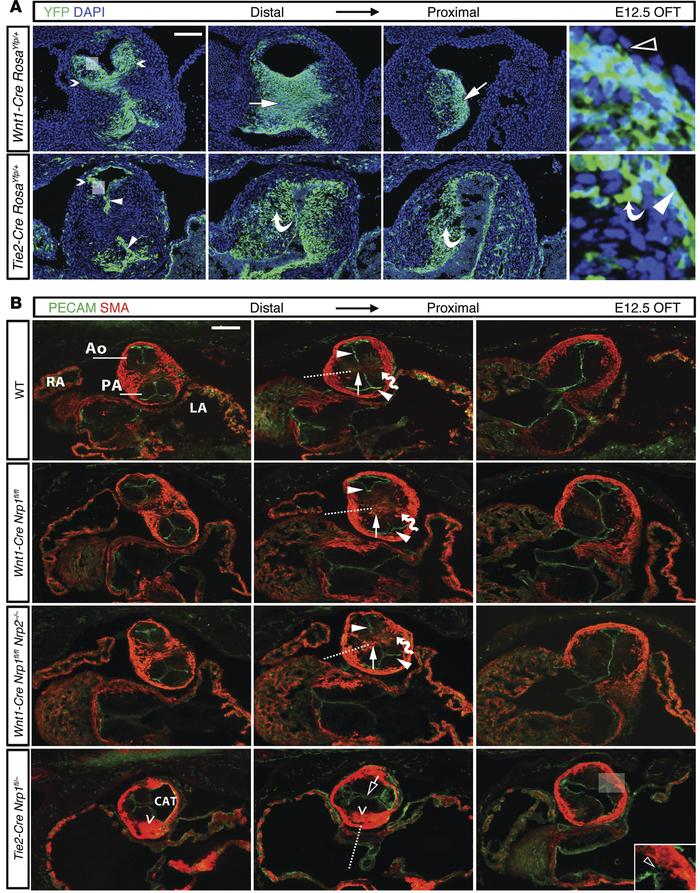 Endothelial-, not NCC-derived NRP1 enables OFT septation.
(A) Serial sec...