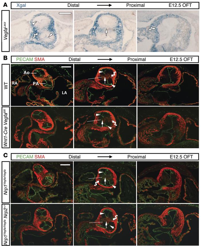 VEGF-A signaling through NRP1 is dispensable for OFT septation.
(A) Seri...