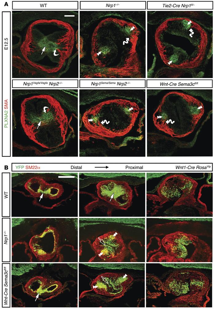 SEMA3C signals through NRP1 to promote convergence of cardiac NCCs and s...