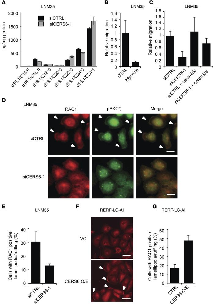 Migration activity in association with ceramide synthesis and lamellipod...