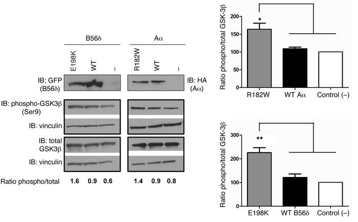 Increased phosphorylation of GSK-3β Ser9 upon expression of B56δ-E198K o...