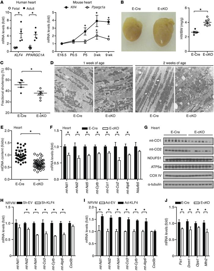 Myocardial KLF4 is required for postnatal mitochondrial biogenesis and c...