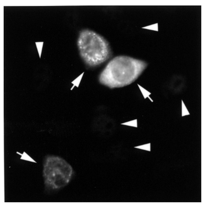 Transient transfection of pp75 cDNA showed cytoplasmic expression in HeL...
