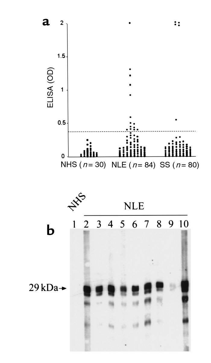 Human autoantibody to recombinant pp75 in sera from mothers of children ...