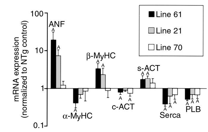 Analysis for cardiac gene expression involved in hypertrophic/failure re...