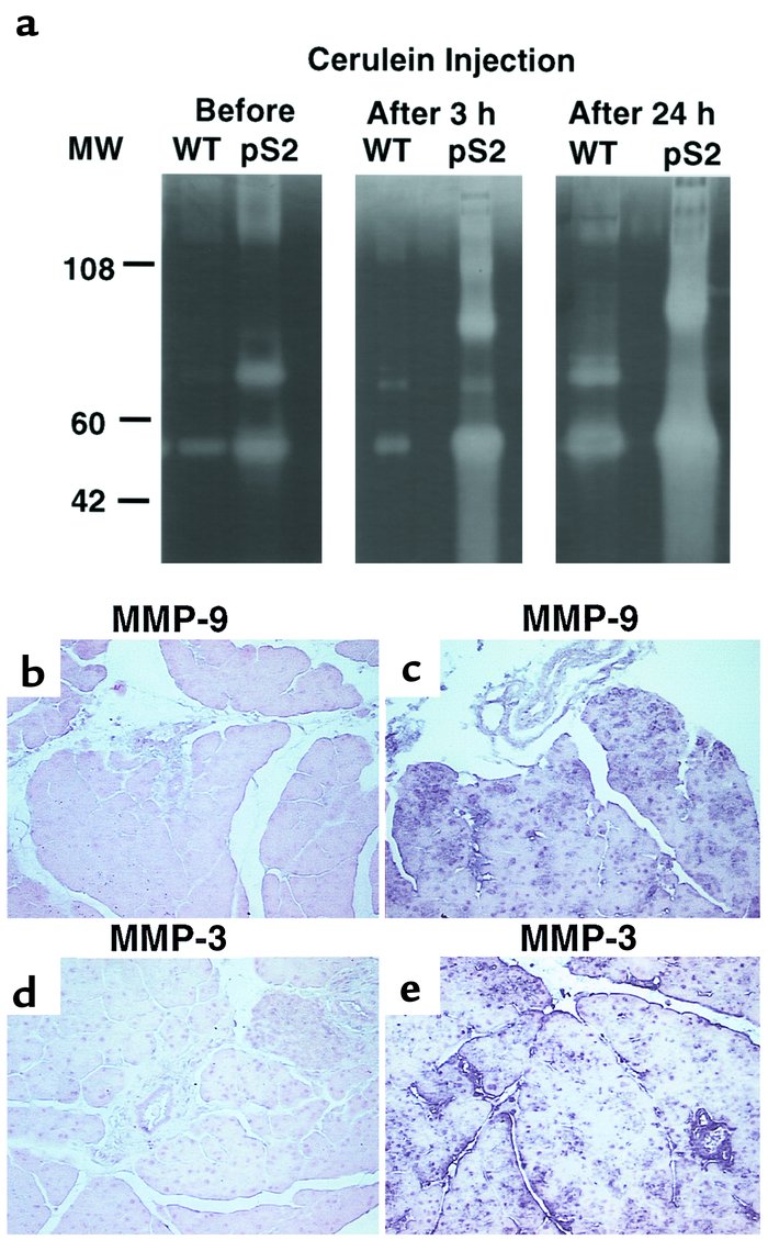 MMP activities in pancreatic homogenates of wild-type and pS2-dnRII tran...