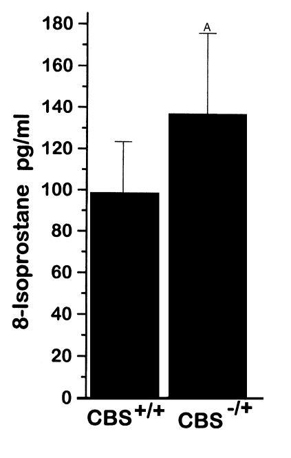 Plasma 8-isoprostane levels from CBS+/+ mice (n = 4) and CBS–/+ mice (n ...
