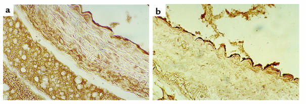 Aortic arch cross sections stained for eNOS in (a) CBS+/+ and (b) CBS–/+...