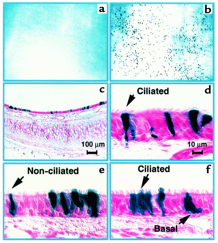 Gene transfer to rabbit tracheal epithelia in vivo using FIV-βgal vector...