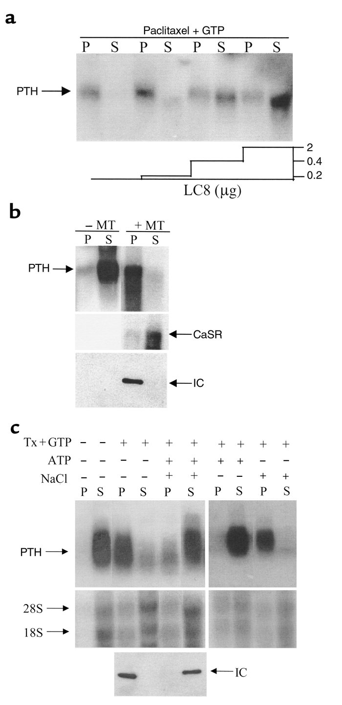 PTH mRNA colocalization with microtubules is dependent upon LC8. (a) Pur...