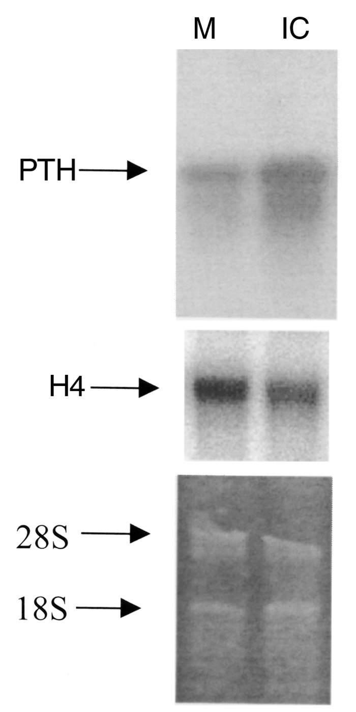 PTH mRNA was immunoprecipitated with IC antibodies. Parathyroid extracts...