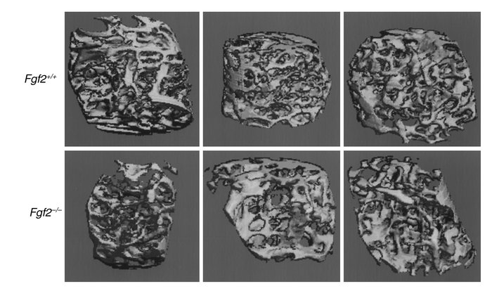 Morphological study by micro-CT scanning of trabecular bone of the femur...