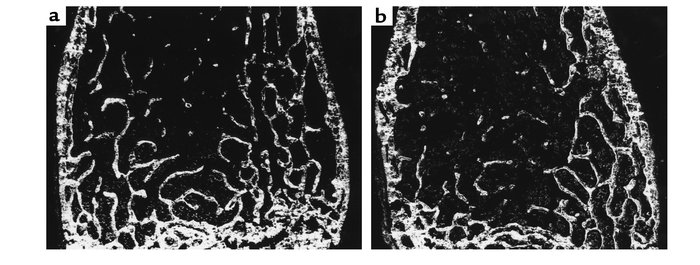 Undecalcified sections of the distal femur of (a) an 8-month-old Fgf2+/+...