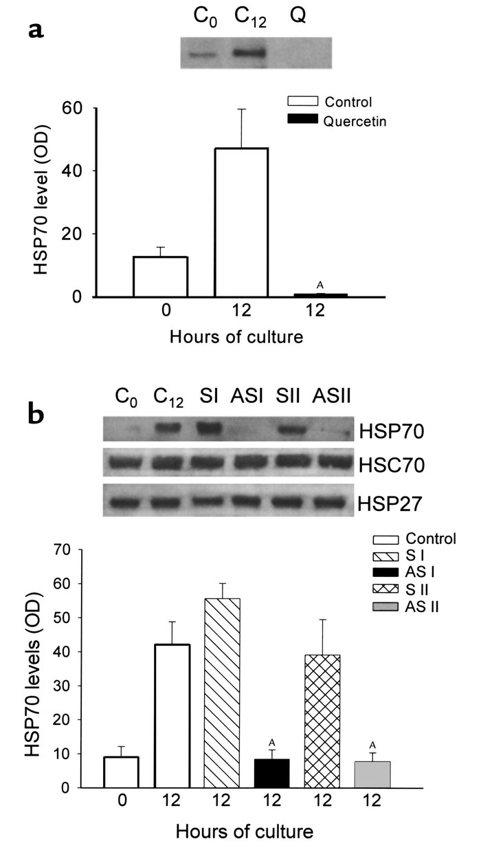 Effect of incubation of pancreas fragments with quercetin or antisense/s...