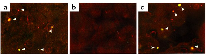 Light microscopic colocalization of TAP and cathepsin B in rat pancreas ...