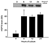 Effect of duration of culture on HSP70 expression in pancreas fragments, as