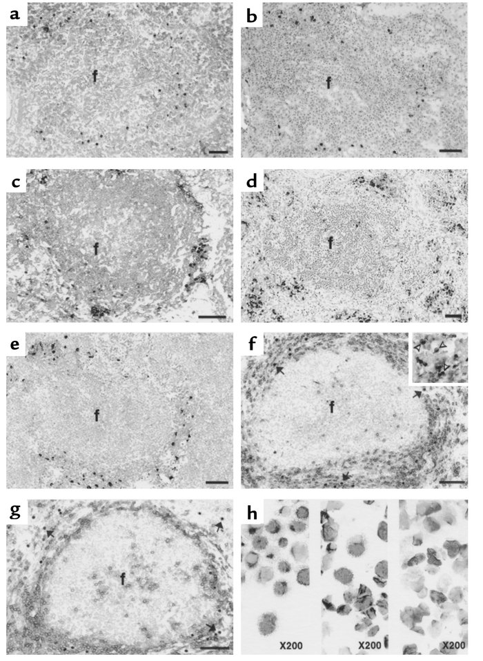 Representative histologic sections of inguinal lymph node collected from...