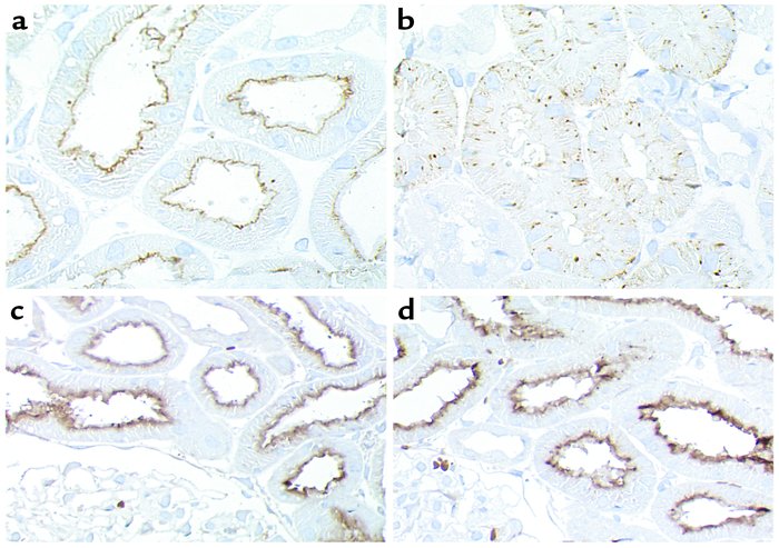 Localization of cubilin (a and b) and megalin (c and d) in kidney cortex...