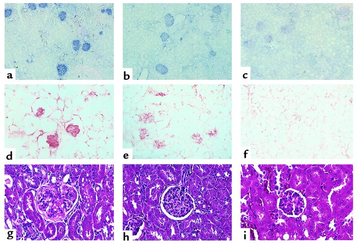 Kidneys from both pfp GVHD and chronic GVHD mice exhibit glomerulonephri...