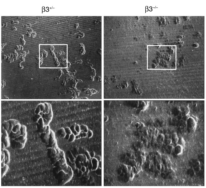 The resorptive capacity of β3–/– osteoclasts is defective. Osteoclasts w...