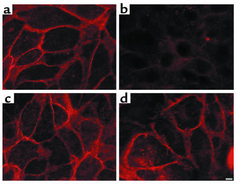 Immunofluorescence localization of Na+-K+-ATPase α-subunit and AE1/2 in ...