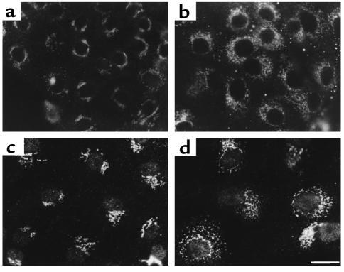 Immunofluorescence localization of β-COP and giantin distribution in AQP...