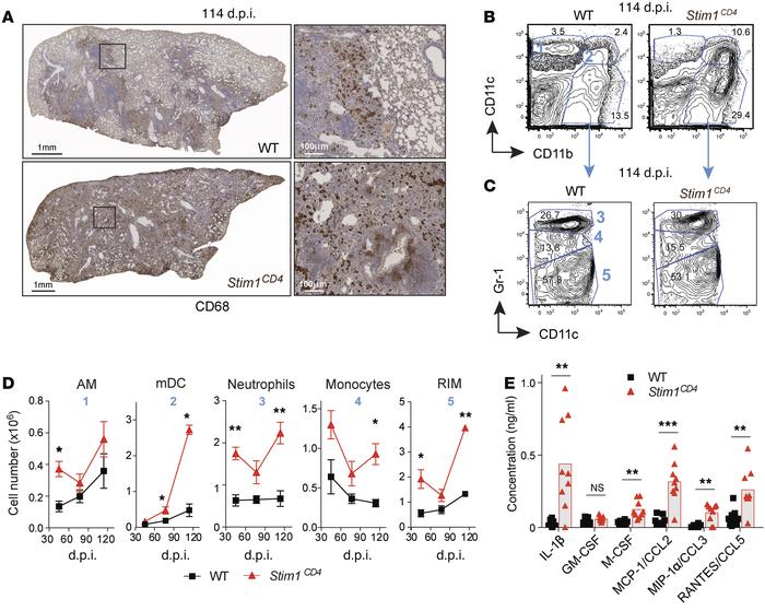 STIM1 in T cells controls myeloid cell infiltration of Mtb-infected lung...
