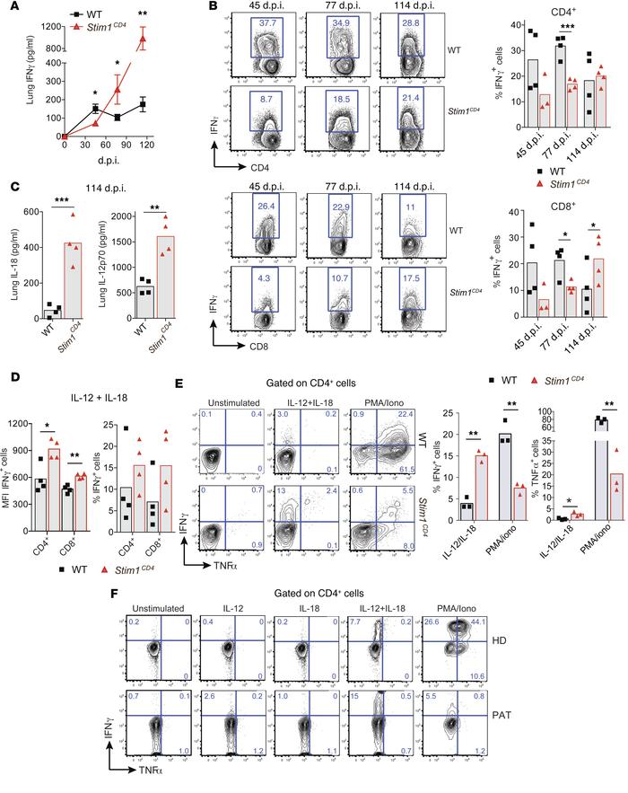 STIM1 is required for IFN-γ production during acute but not chronic Mtb ...