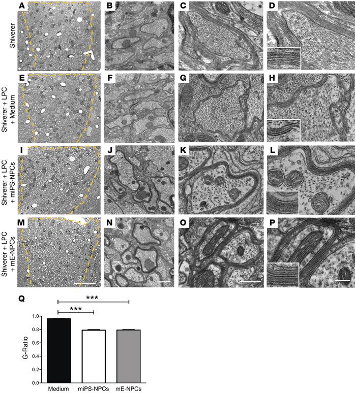 JCI - Skin-derived neural precursors competitively generate functional ...