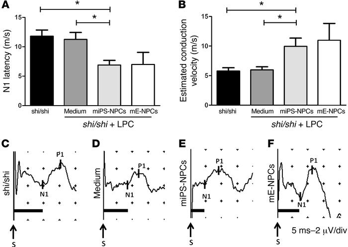 miPS-derived myelin improves conduction of the dysfunctional Shi/Shi Rag...