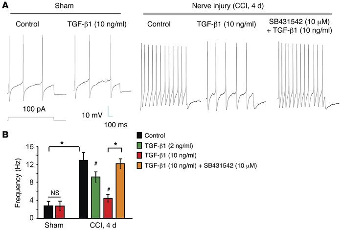 Exogenous TGF-β1 blocks CCI-induced increases in action potential freque...