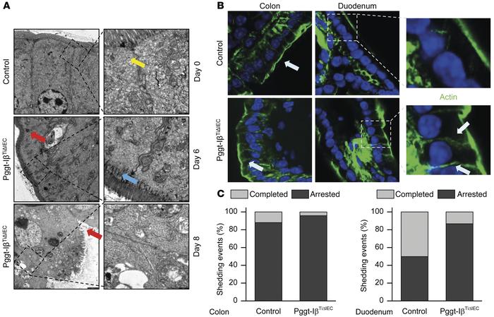 Cytoskeleton rearrangement and cell shedding within GGTase-Iβ–deficient ...