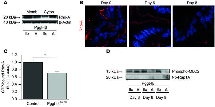 Rho-A dysfunction in Pggt-IβTiΔIEC mice.
(A) Western blot of Rho-A in me...