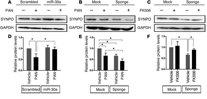 miR-30s maintain SYNPO protein expression in podocytes.
(A) Immunoblotti...