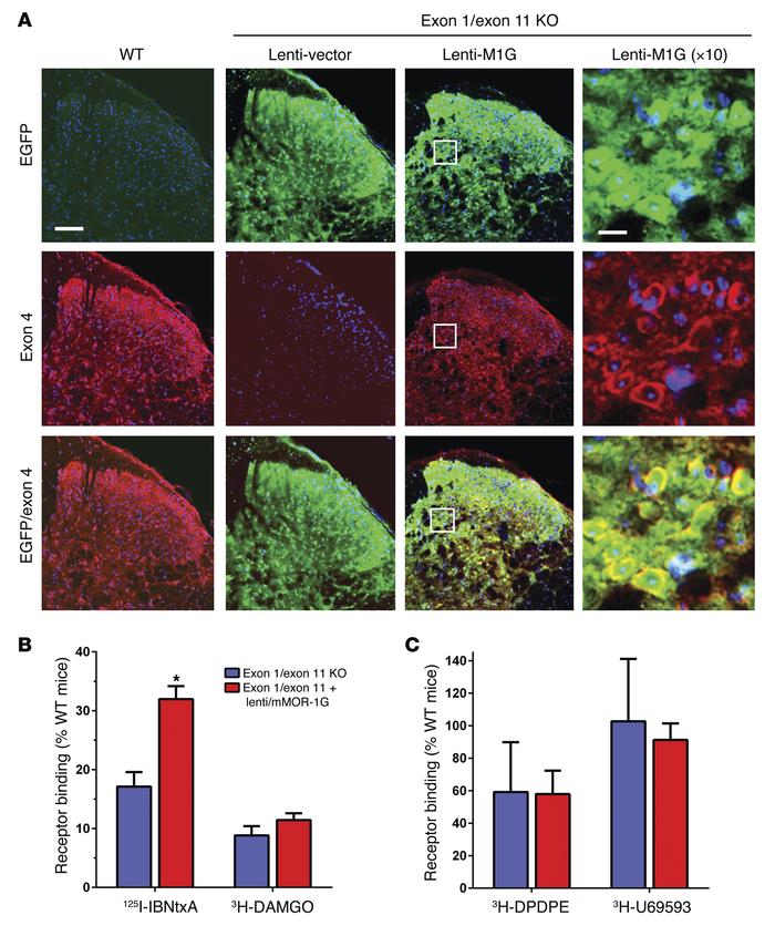 Lentivirus expression in the spinal cord following intrathecal administr...