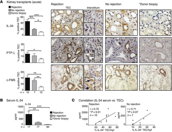 Intrarenal IL-34 is increased in engrafted and rejected kidney transplan...