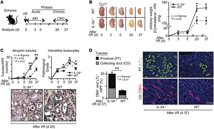 JCI - IL-34 mediates acute kidney injury and worsens subsequent chronic ...
