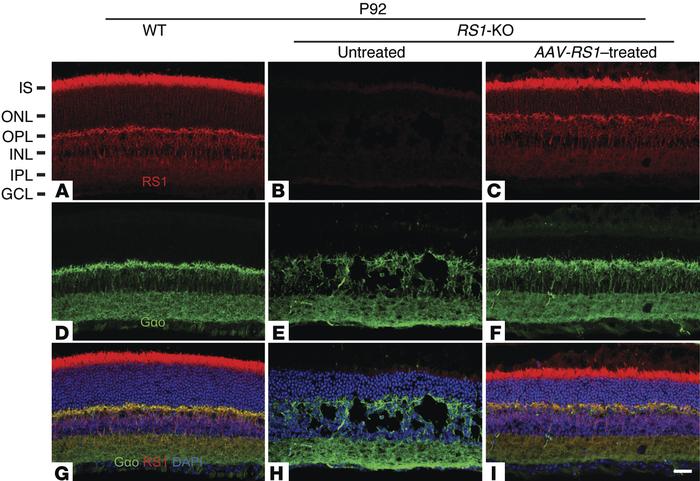 RS1 expression in AAV8-scRS/IRBP-hRS1–injected and uninjected Rs1-KO mic...