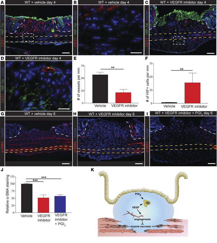 VEGFR inhibition leads to defective angiogenesis and penetrating ulcers ...