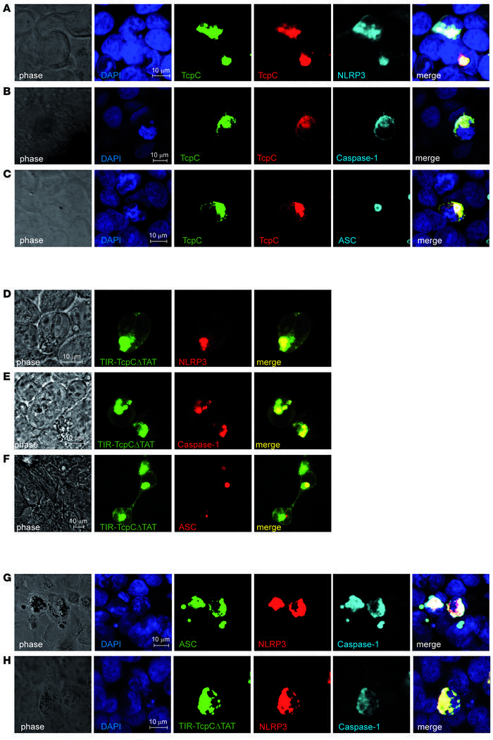 TcpC colocalized with NLRP3 and caspase-1.
We transfected HEK293 cells w...