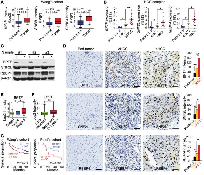 NURF complex levels are consistent with HCC severity and prognosis.
(A) ...