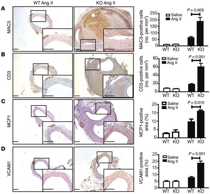 CCN3 deficiency promotes a proinflammatory response.
Representative imag...