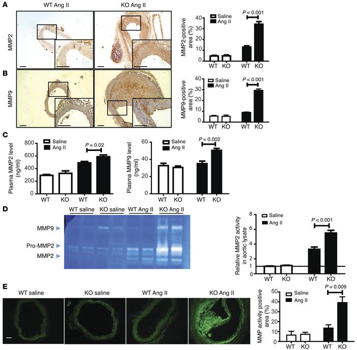 CCN3 deficiency promotes MMP production in CCN3-deficient aortas followi...