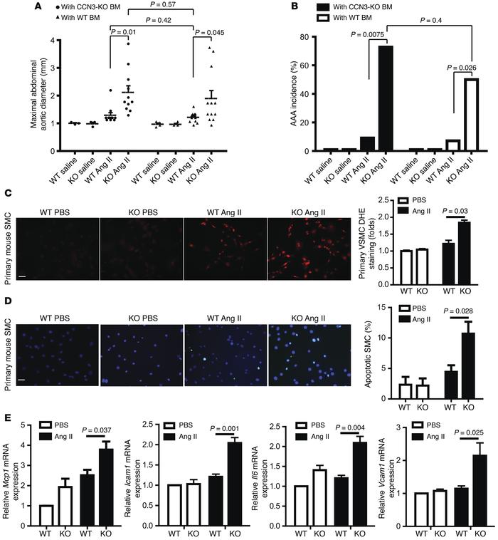 The AAA phenotype in CCN3-deficient mice is intrinsic to the vascular wa...