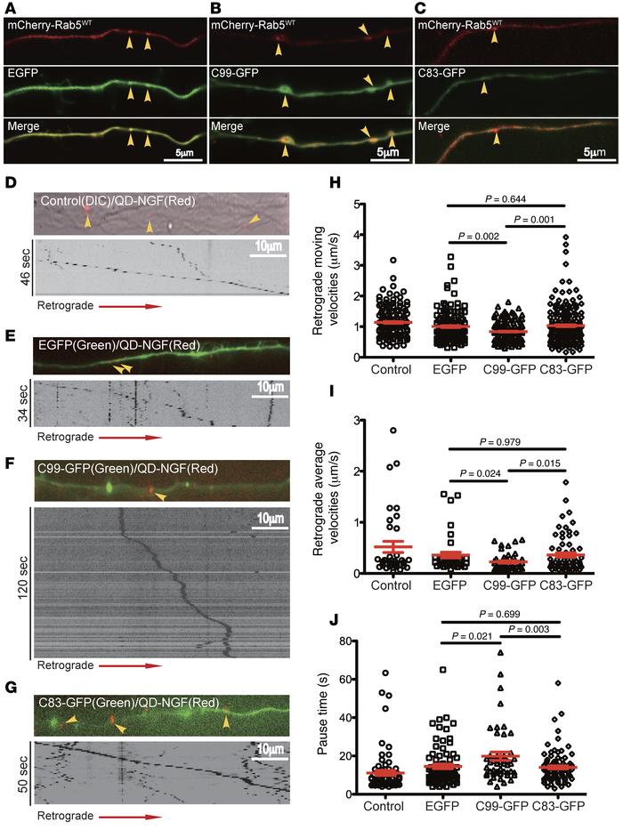 C99 inhibited retrograde axonal transport of NGF in BFCNs.
(A) Rat E18 B...