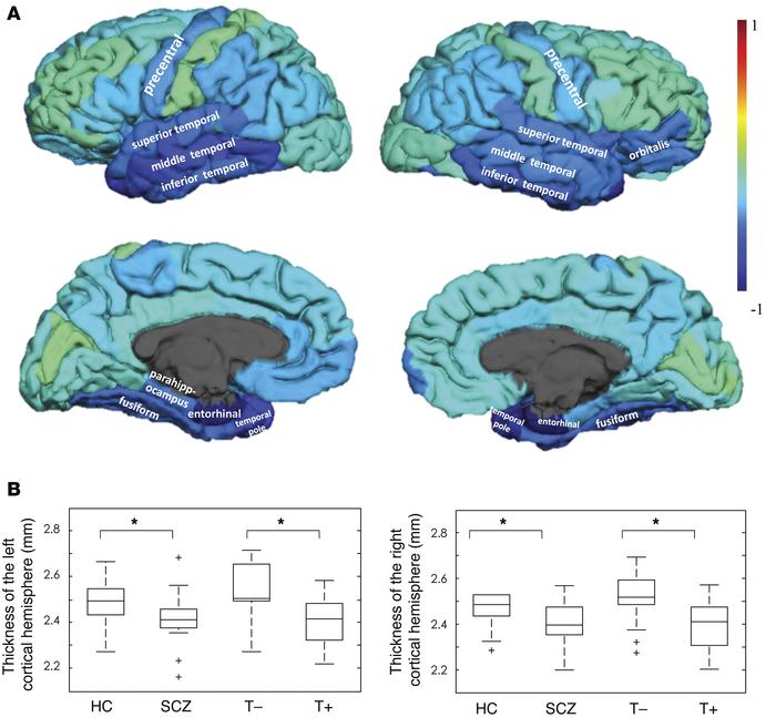 Pattern of cortical thickness across the groups.
(A) Surface-based weigh...