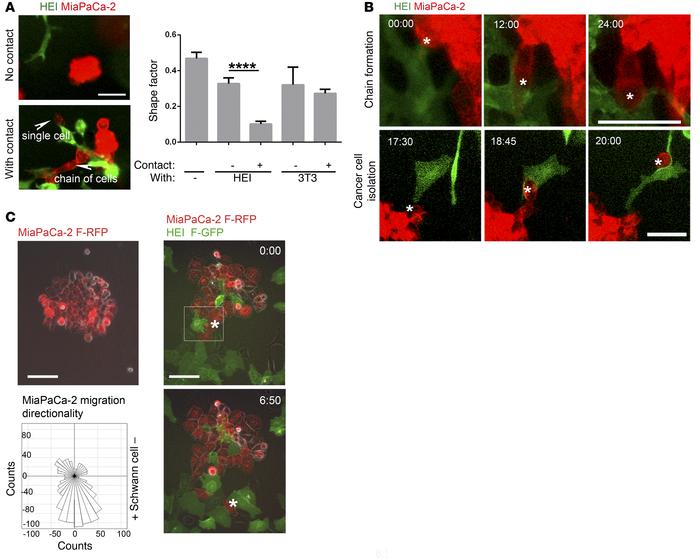Schwann cells reorganize and disperse cancer cells.
(A) Cancer cell clus...