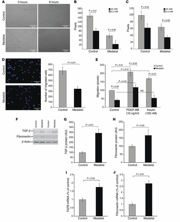 Effect of high glucose levels on fibroblast migration and ECM protein se...